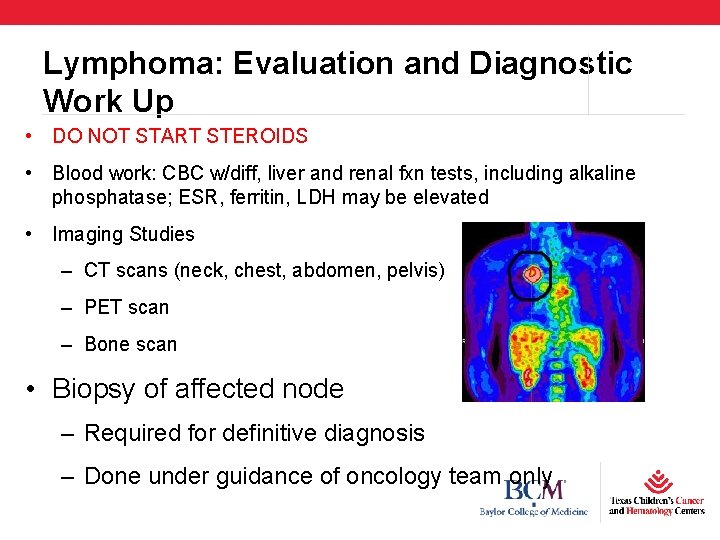 Lymphoma: Evaluation and Diagnostic Work Up • DO NOT START STEROIDS • Blood work: