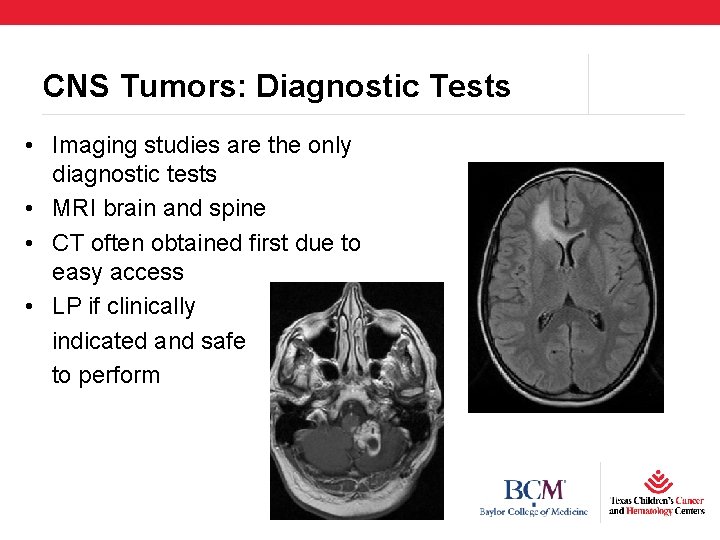 CNS Tumors: Diagnostic Tests • Imaging studies are the only diagnostic tests • MRI