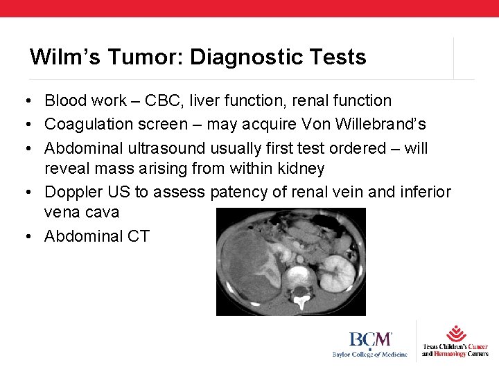 Wilm’s Tumor: Diagnostic Tests • Blood work – CBC, liver function, renal function •