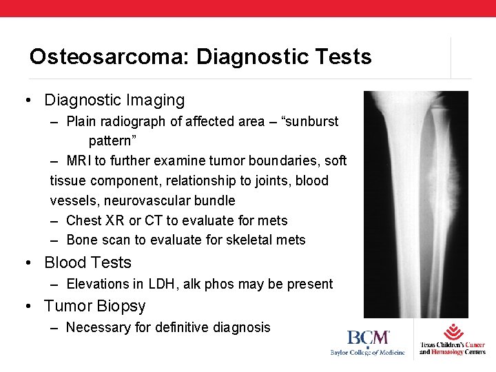 Osteosarcoma: Diagnostic Tests • Diagnostic Imaging – Plain radiograph of affected area – “sunburst