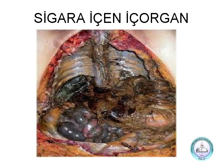 SİGARA İÇEN İÇORGAN 