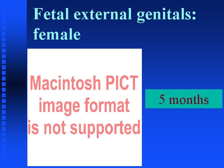 Fetal external genitals: female 5 months 