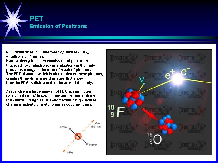 PET Emission of Positrons PET radiotracer (18 F fluorodeoxyglucose (FDG)) + radioactive fluorine. Natural