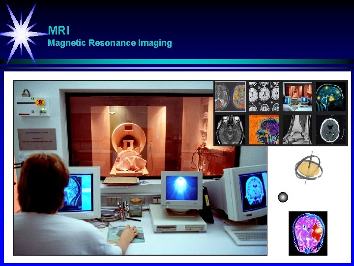 MRI Magnetic Resonance Imaging 
