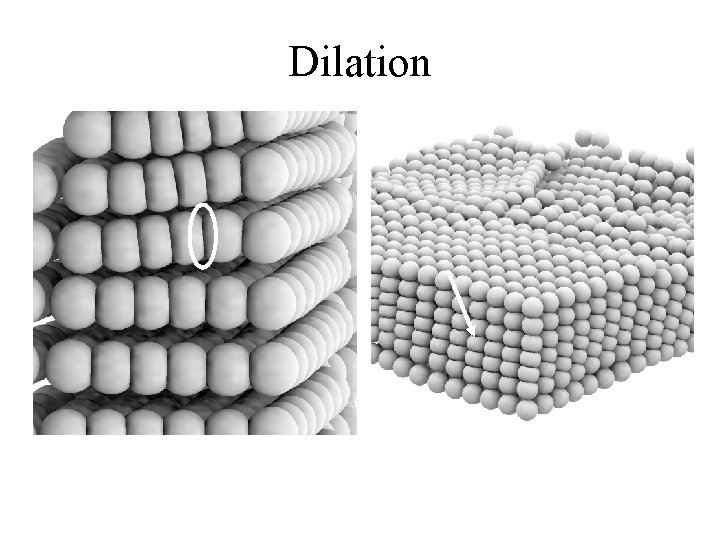 Dilation 