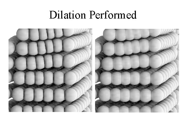 Dilation Performed 