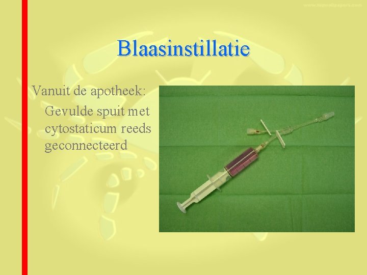 Blaasinstillatie Vanuit de apotheek: Gevulde spuit met cytostaticum reeds geconnecteerd 