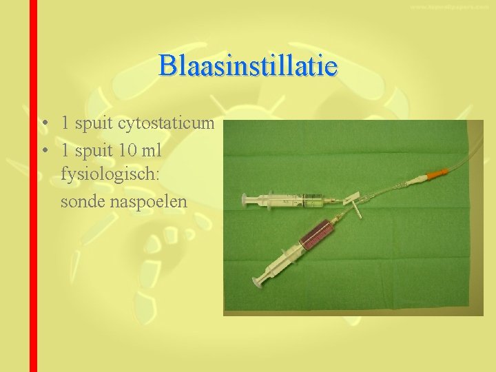 Blaasinstillatie • 1 spuit cytostaticum • 1 spuit 10 ml fysiologisch: sonde naspoelen 