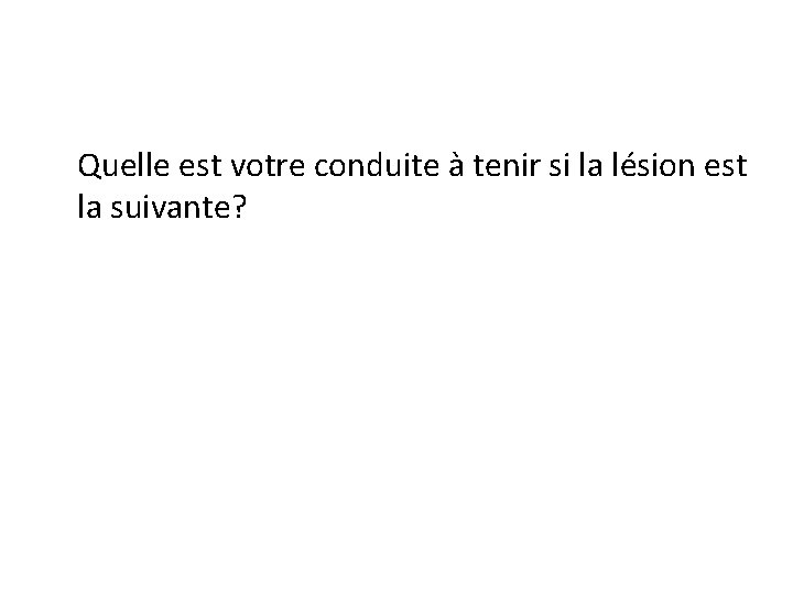 Quelle est votre conduite à tenir si la lésion est la suivante? Quelle est votre conduite à tenir si la lésion est la suivante?
