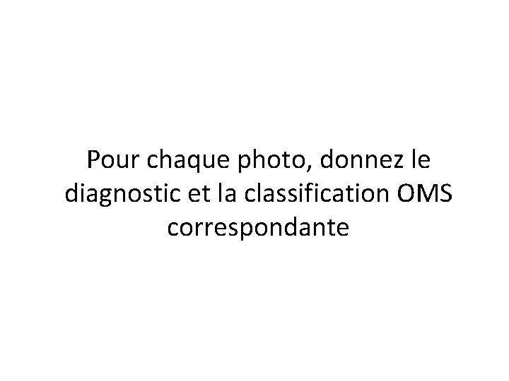 Pour chaque photo, donnez le diagnostic et la classification OMS correspondante Pour chaque photo, donnez le diagnostic et la classification OMS correspondante