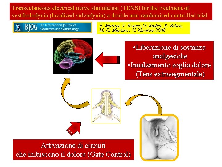 Transcutaneous electrical nerve stimulation (TENS) for the treatment of vestibolodynia (localized vulvodynia): a double