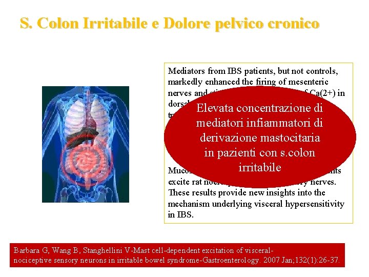 S. Colon Irritabile e Dolore pelvico cronico Mediators from IBS patients, but not controls,