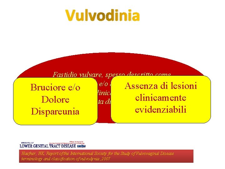 Vulvodinia Fastidio vulvare, spesso descritto come bruciore e/dolore e/o dispareunia in assenza Assenza di