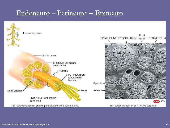 Endoneuro – Perineuro -- Epineuro Principles of Human Anatomy and Physiology, 11 e 41