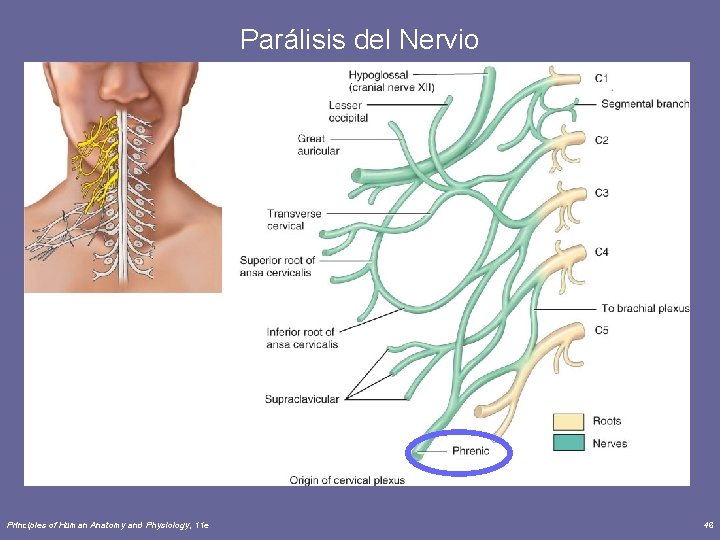 Parálisis del Nervio Principles of Human Anatomy and Physiology, 11 e 46 