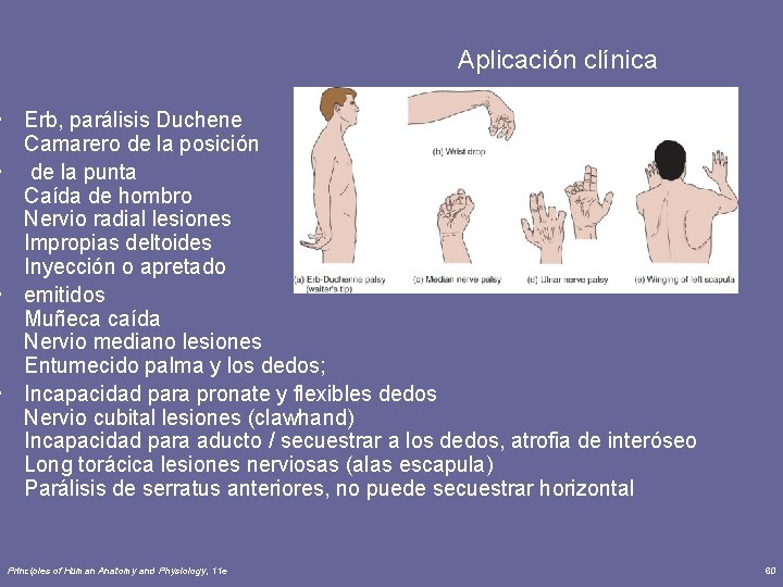 Aplicación clínica • Erb, parálisis Duchene Camarero de la posición • de la punta