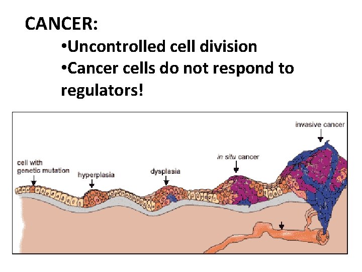 CANCER: • Uncontrolled cell division • Cancer cells do not respond to regulators! 