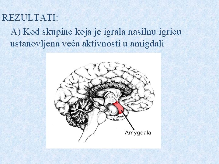 REZULTATI: A) Kod skupine koja je igrala nasilnu igricu ustanovljena veća aktivnosti u amigdali