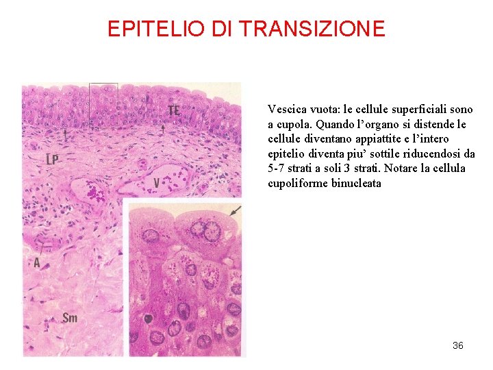 EPITELIO DI TRANSIZIONE Vescica vuota: le cellule superficiali sono a cupola. Quando l’organo si