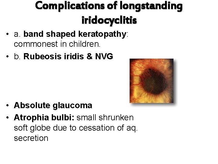 Complications of longstanding iridocyclitis • a. band shaped keratopathy: keratopathy commonest in children. •
