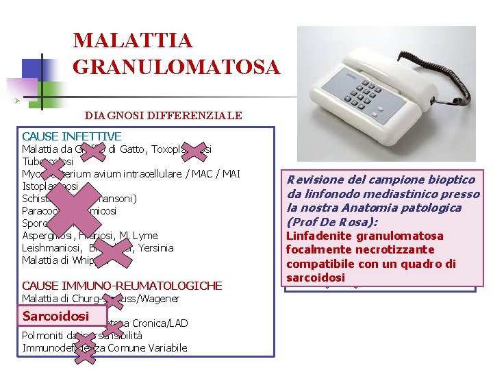 MALATTIA GRANULOMATOSA Ø DIAGNOSI DIFFERENZIALE CAUSE INFETTIVE Malattia da Graffio di Gatto, Toxoplasmosi Tubercolosi