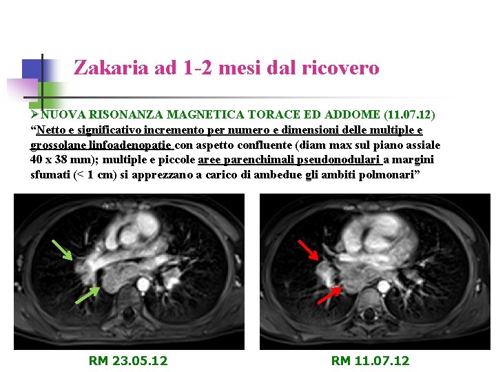 Zakaria ad 1 -2 mesi dal ricovero ØNUOVA RISONANZA MAGNETICA TORACE ED ADDOME (11.