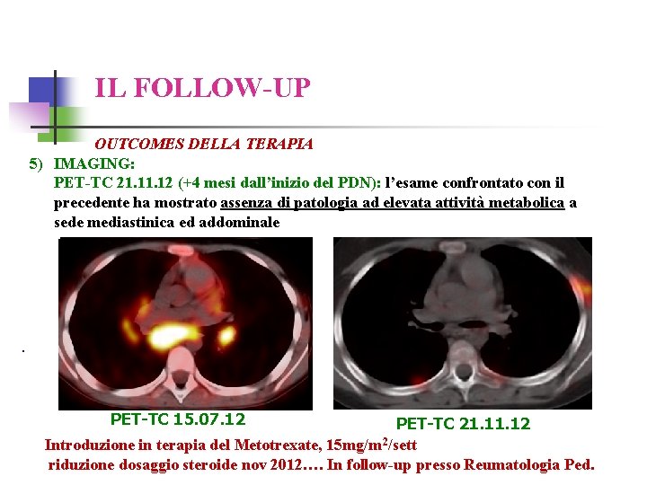 IL FOLLOW-UP OUTCOMES DELLA TERAPIA 5) IMAGING: PET-TC 21. 12 (+4 mesi dall’inizio del