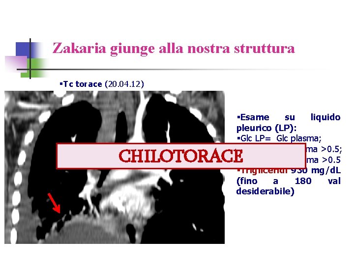 Zakaria giunge alla nostra struttura §Tc torace (20. 04. 12) §Esame su liquido pleurico