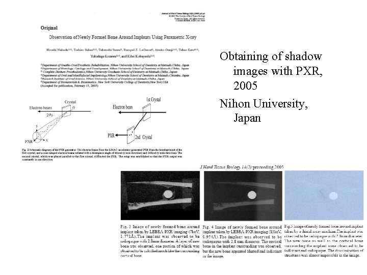 Obtaining of shadow images with PXR, 2005 Nihon University, Japan 