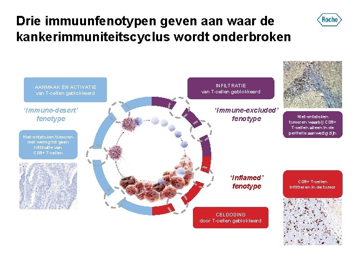 Drie immuunfenotypen geven aan waar de kankerimmuniteitscyclus wordt onderbroken AANMAAK EN ACTIVATIE van T-cellen