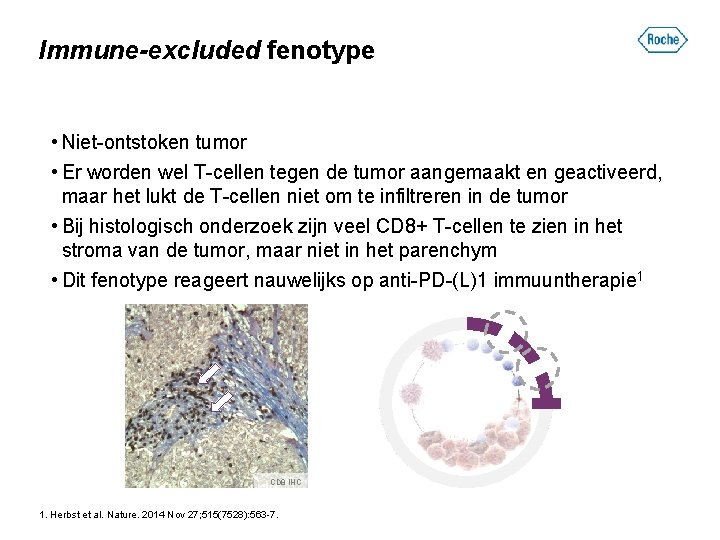 Immune-excluded fenotype • Niet-ontstoken tumor • Er worden wel T-cellen tegen de tumor aangemaakt