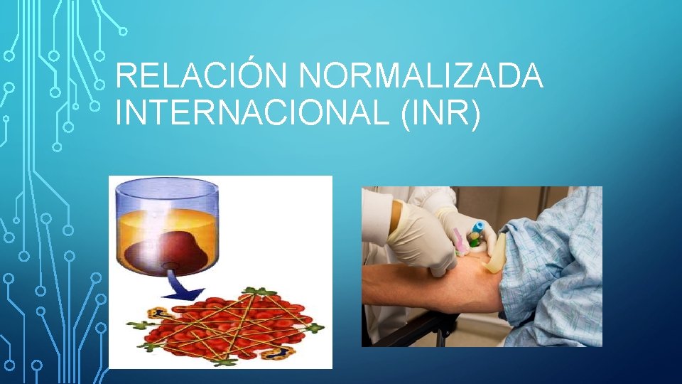 RELACIÓN NORMALIZADA INTERNACIONAL (INR) 