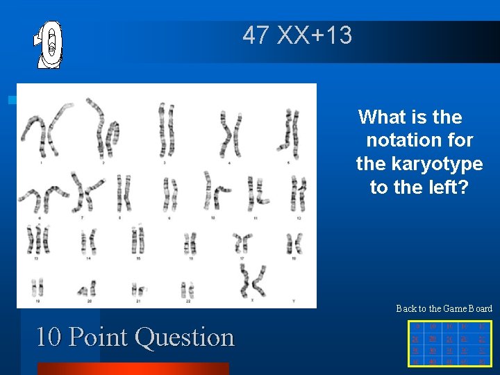 47 XX+13 What is the notation for the karyotype to the left? Back to