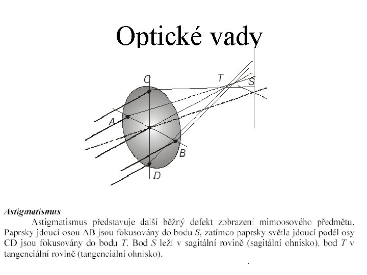 Optické vady 