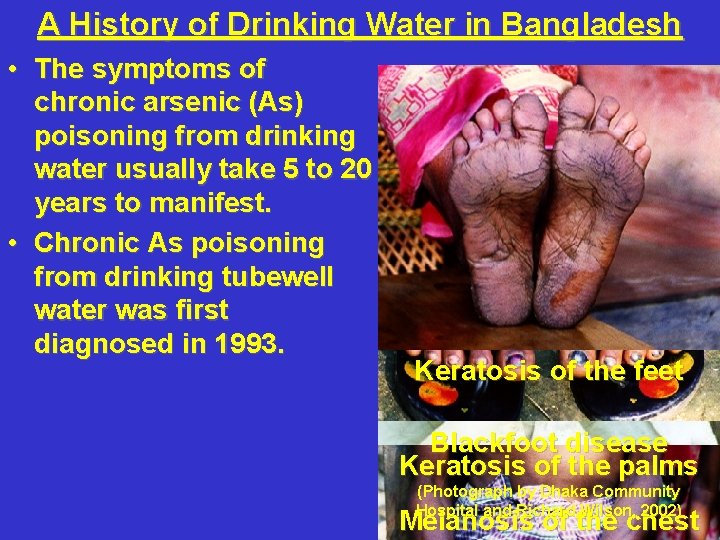 A History of Drinking Water in Bangladesh • The symptoms of chronic arsenic (As)