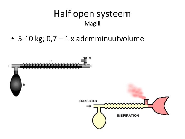 Half open systeem Magill • 5 -10 kg; 0, 7 – 1 x ademminuutvolume