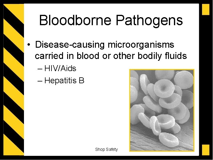 Bloodborne Pathogens • Disease-causing microorganisms carried in blood or other bodily fluids – HIV/Aids