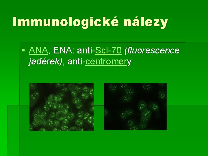Immunologické nálezy § ANA, ENA: anti-Scl-70 (fluorescence jadérek), anti-centromery 