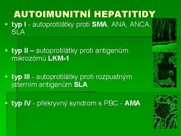 AUTOIMUNITNÍ HEPATITIDY § typ I - autoprotilátky proti SMA, ANCA, SLA § typ II