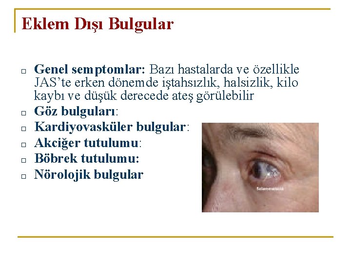 Eklem Dışı Bulgular □ □ □ Genel semptomlar: Bazı hastalarda ve özellikle JAS’te erken Eklem Dışı Bulgular □ □ □ Genel semptomlar: Bazı hastalarda ve özellikle JAS’te erken