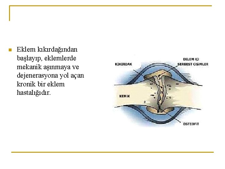 n Eklem kıkırdağından başlayıp, eklemlerde mekanik aşınmaya ve dejenerasyona yol açan kronik bir eklem n Eklem kıkırdağından başlayıp, eklemlerde mekanik aşınmaya ve dejenerasyona yol açan kronik bir eklem