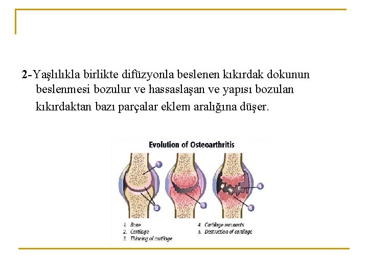 2 -Yaşlılıkla birlikte difüzyonla beslenen kıkırdak dokunun beslenmesi bozulur ve hassaslaşan ve yapısı bozulan 2 -Yaşlılıkla birlikte difüzyonla beslenen kıkırdak dokunun beslenmesi bozulur ve hassaslaşan ve yapısı bozulan