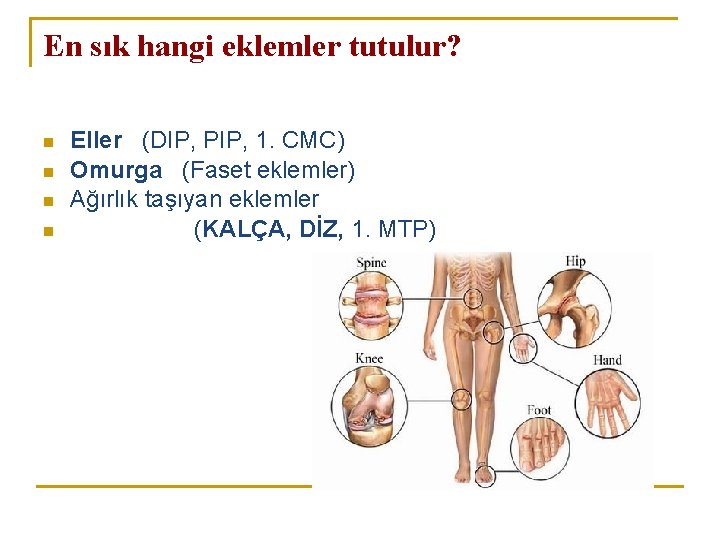 En sık hangi eklemler tutulur? n n Eller (DIP, PIP, 1. CMC) Omurga (Faset En sık hangi eklemler tutulur? n n Eller (DIP, PIP, 1. CMC) Omurga (Faset