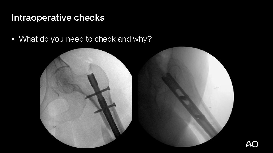 Intraoperative checks • What do you need to check and why? 