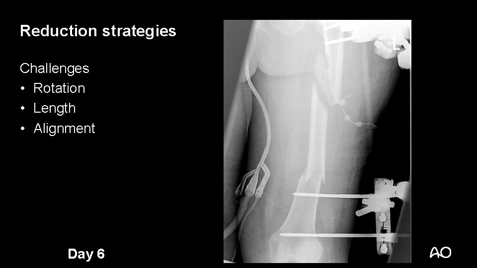 Reduction strategies Challenges • Rotation • Length • Alignment Day 6 