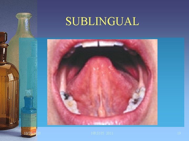 SUBLINGUAL 10/26/2020 NRS 105 2011 19 