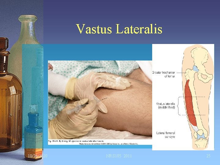 Vastus Lateralis 10/26/2020 NRS 105 2011 25 