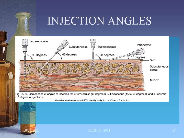 INJECTION ANGLES 10/26/2020 NRS 105 2011 27 