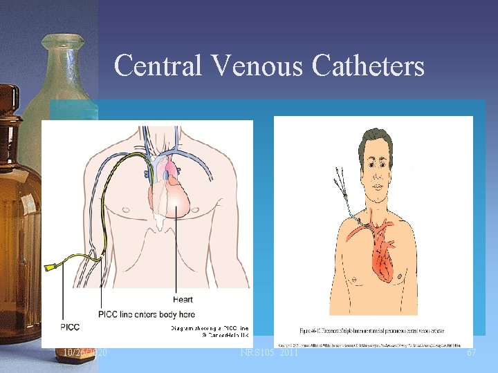 Central Venous Catheters 10/26/2020 NRS 105 2011 67 