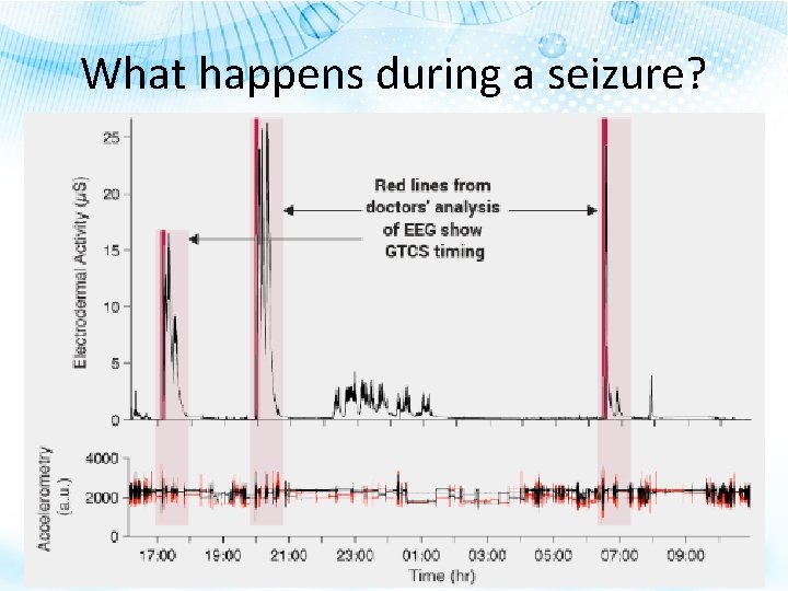 What happens during a seizure? 
